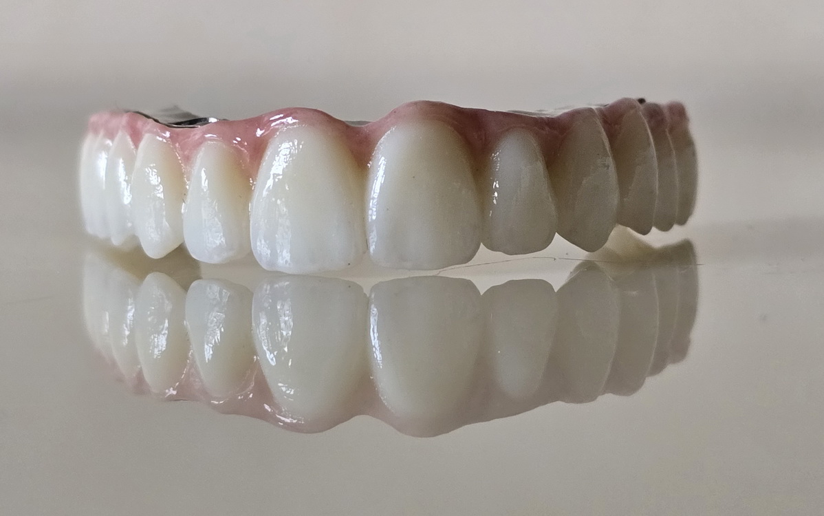 Dents permenentes ImplantFix din Cluj-Napoca